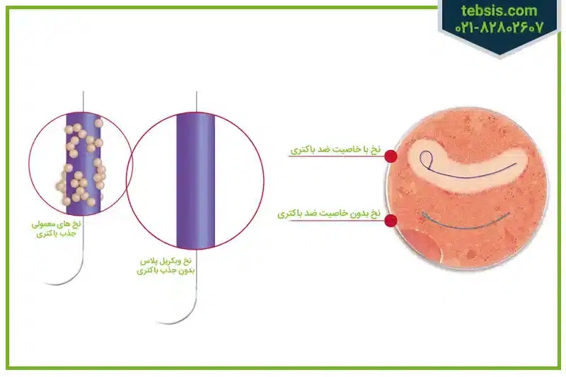 نخ بخیه ویکریل بدون باکتری
